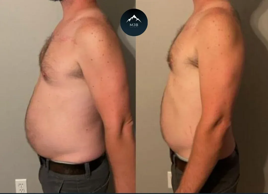 Adam, 5% Body Fat Lost in 4 Weeks