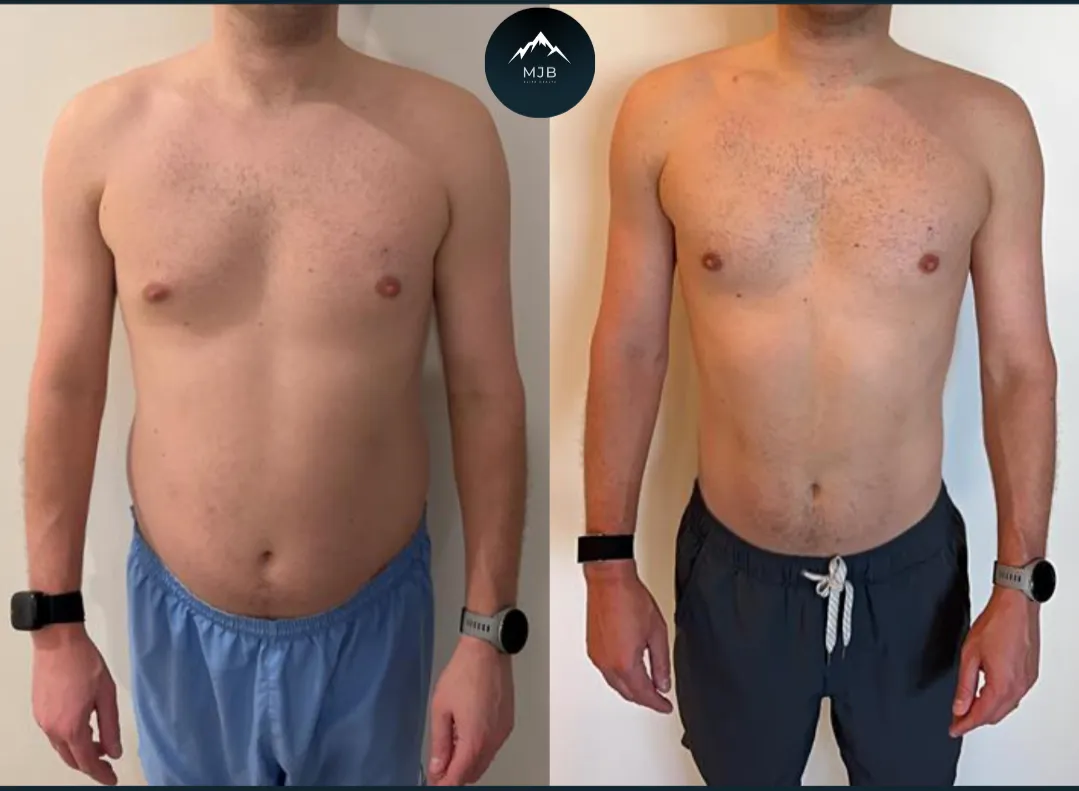 Andrew, lost 10lbs and 4% body fat