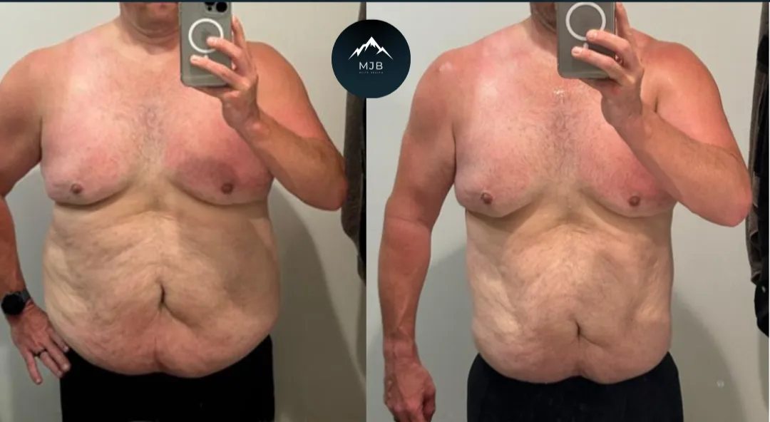 Craig, lost 40lbs in 6 months