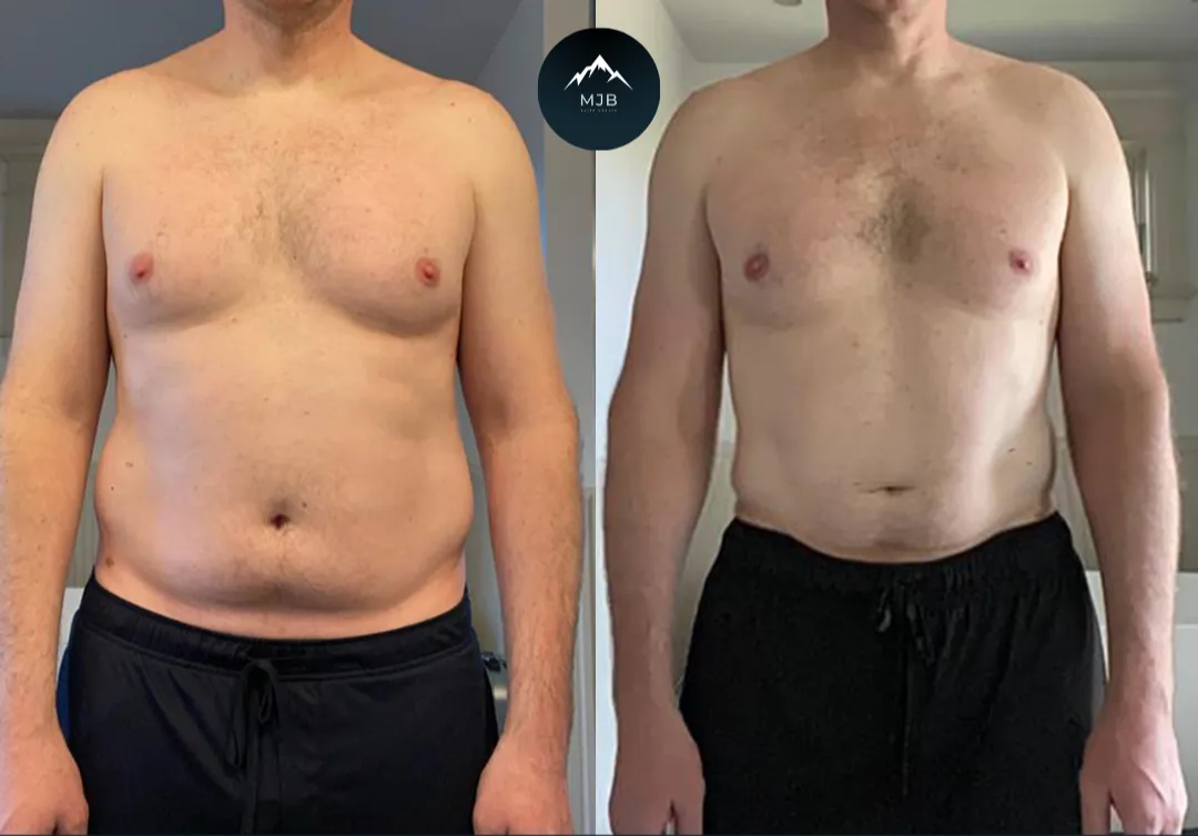 Doug, down 22 lbs in 4 months
