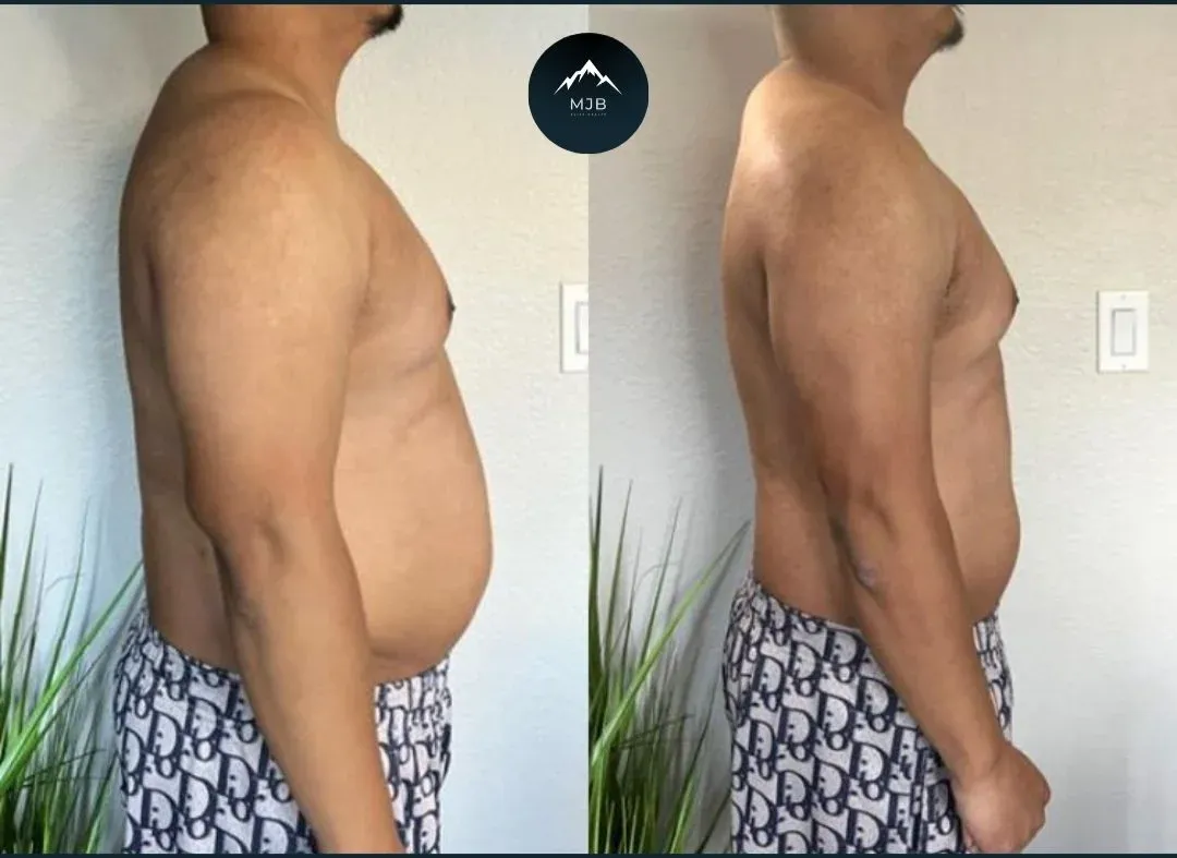 Juan, 15 lbs Lost + Marathon Completed