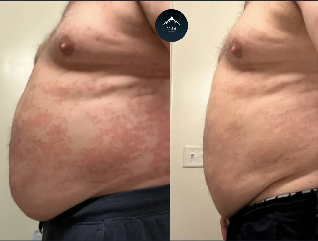 Mark, 32 lbs Lost After Giving Up Hope