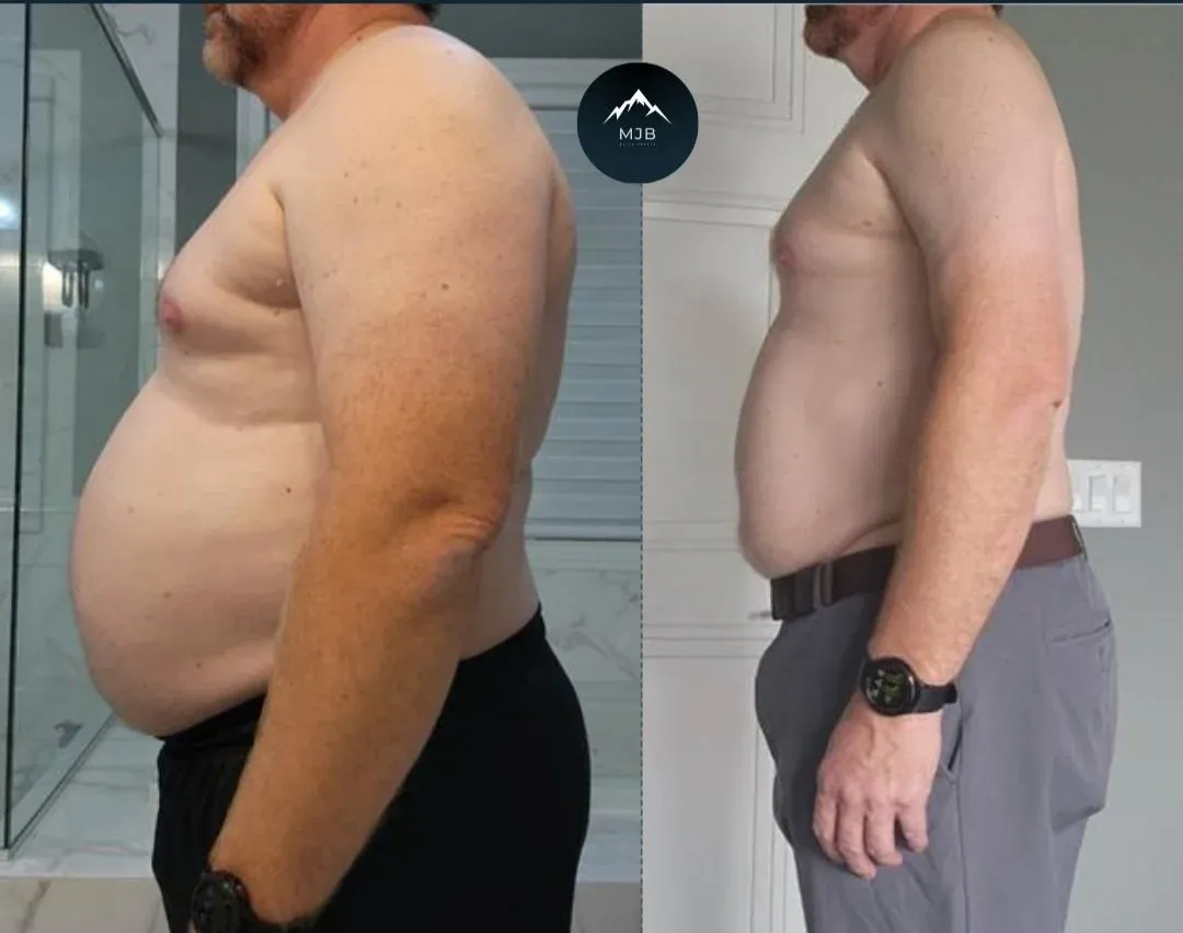 Matt, Down 40 lbs in 6 months