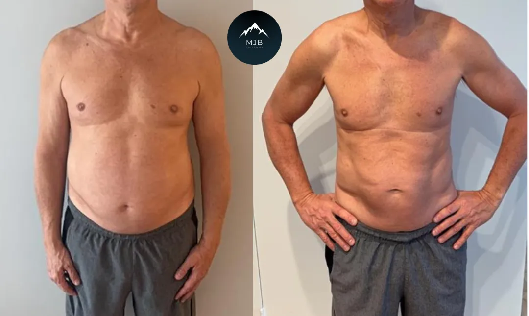 Robert, lost 20lbs in 4 months
